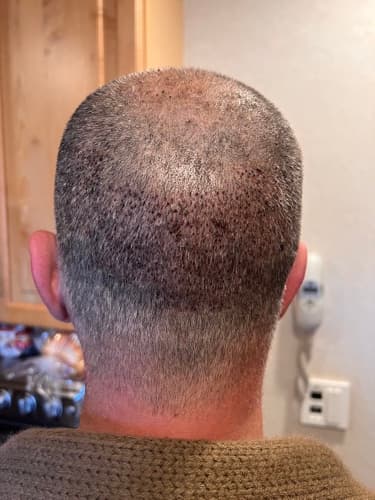 Six days in: healing well